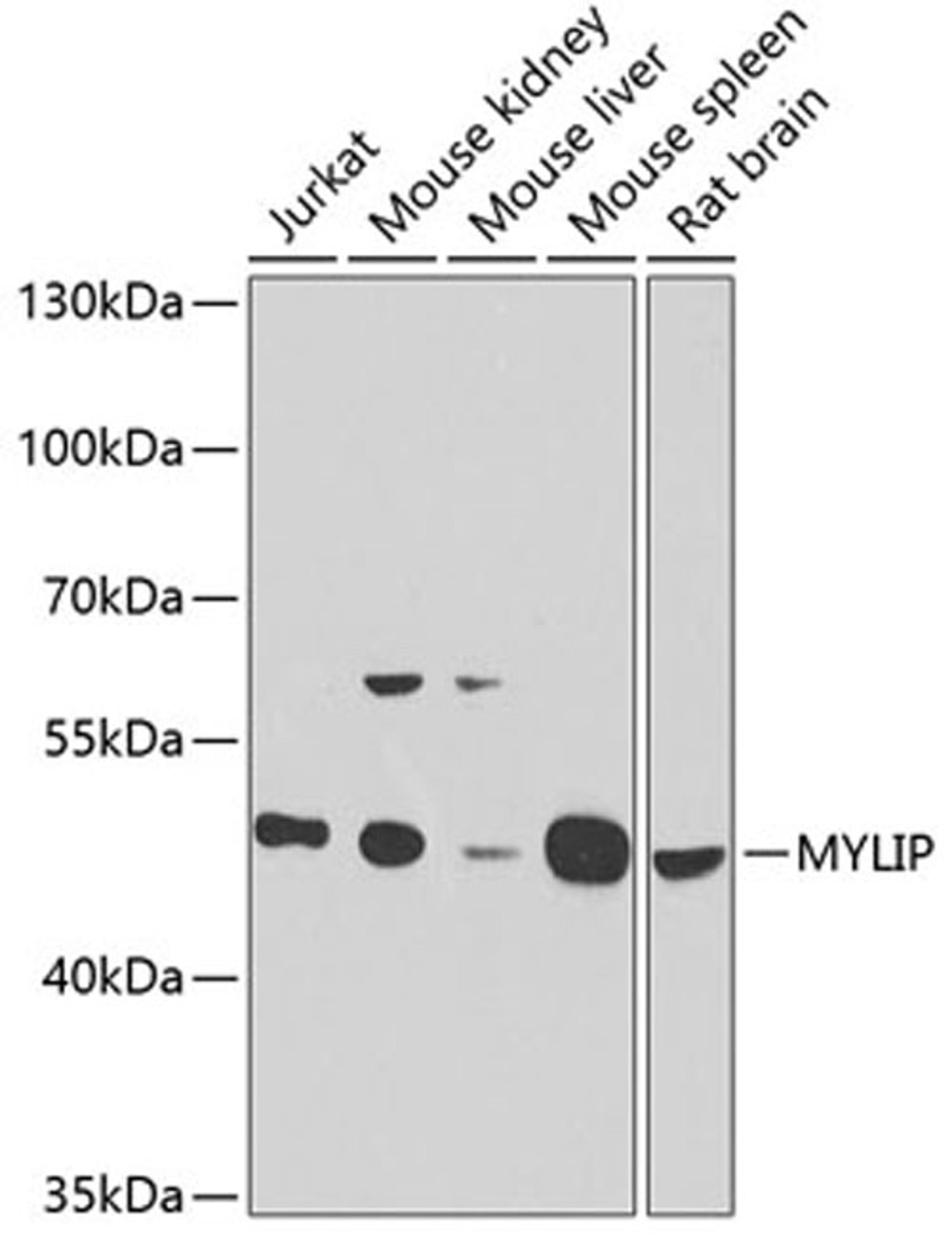 Western blot - MYLIP antibody (A6166)