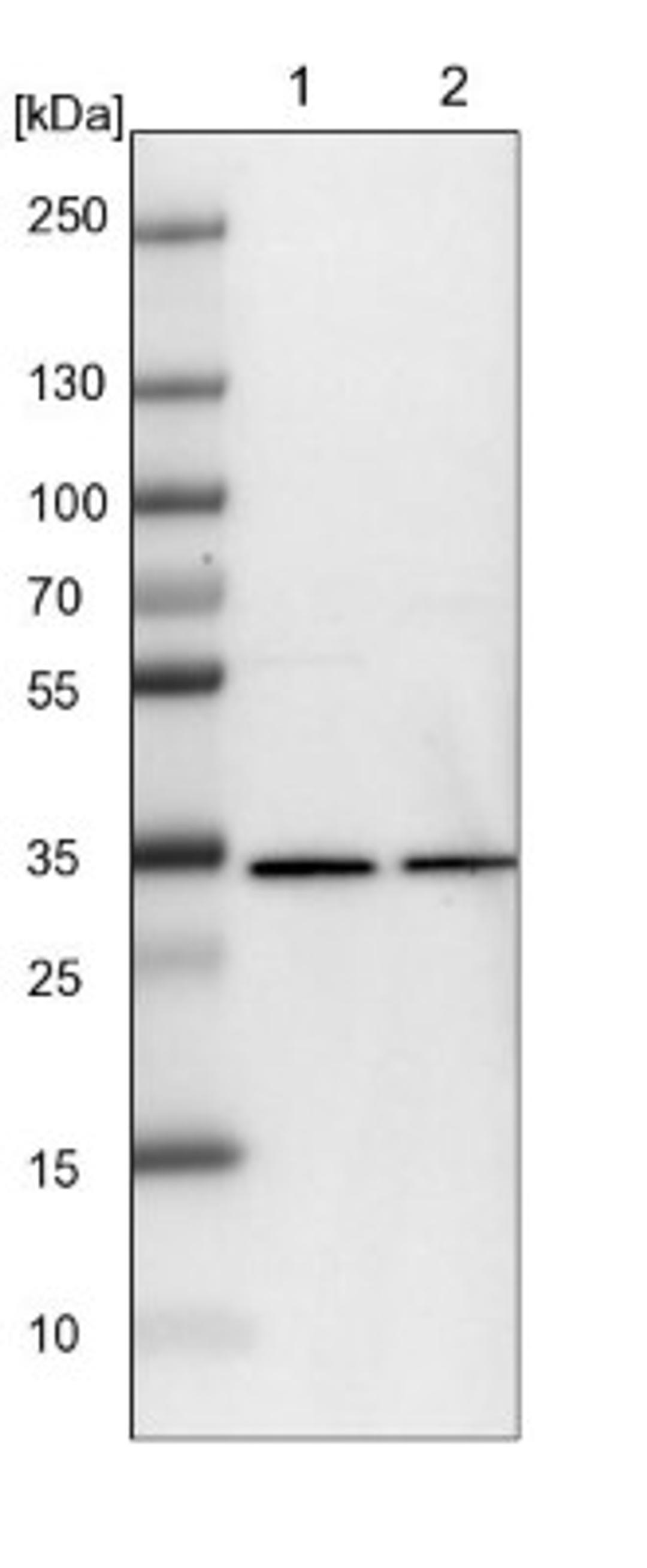 Western Blot: WDR61 Antibody [NBP1-80844] - Lane 1: NIH-3T3 cell lysate (Mouse embryonic fibroblast cells)<br/>Lane 2: NBT-II cell lysate (Rat Wistar bladder tumour cells)