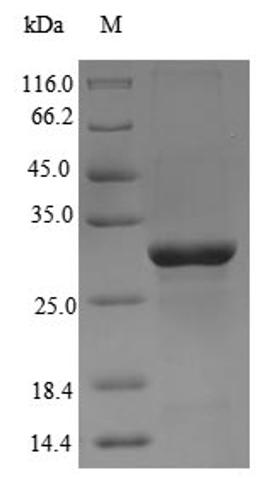 (Tris-Glycine gel) Discontinuous SDS-PAGE (reduced) with 5% enrichment gel and 15% separation gel.