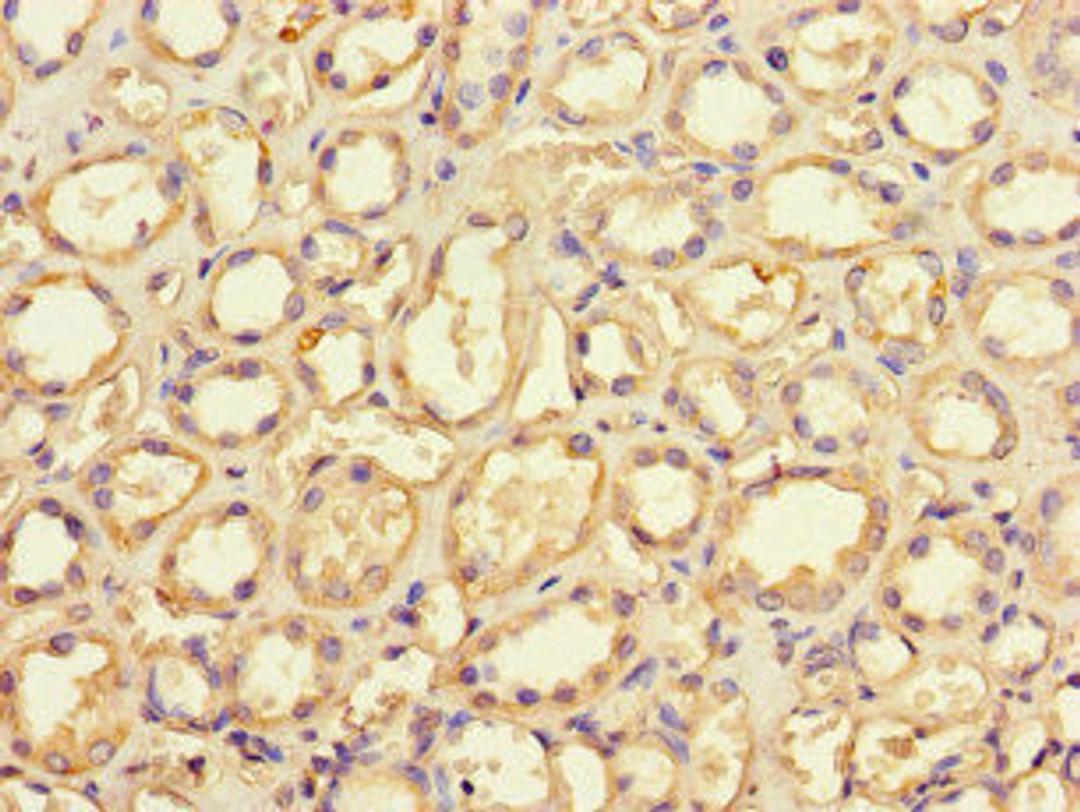 Immunohistochemistry of paraffin-embedded human kidney tissue using CSB-PA009904LA01HU at dilution of 1:100