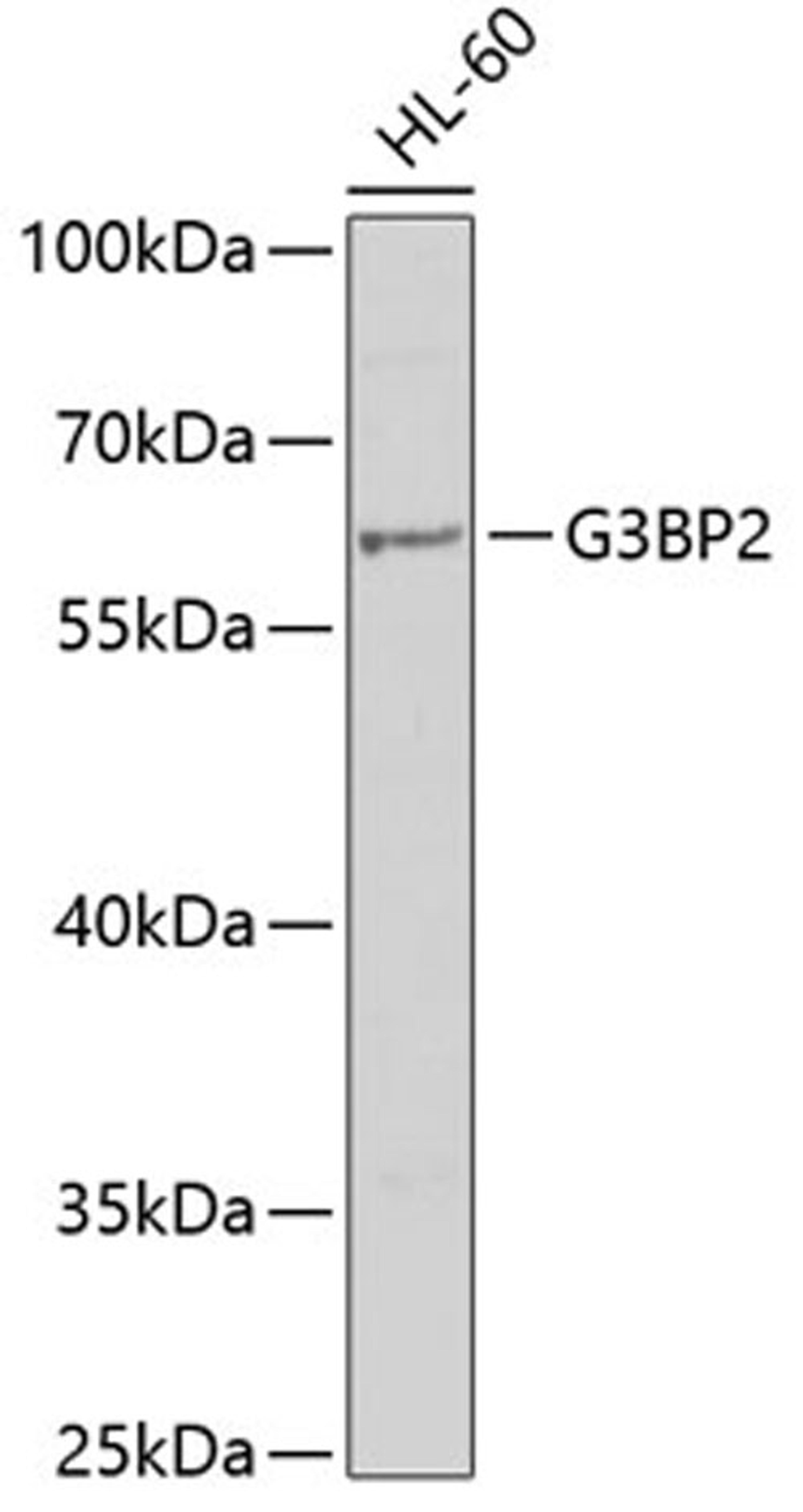 Western blot - G3BP2 antibody (A6026)