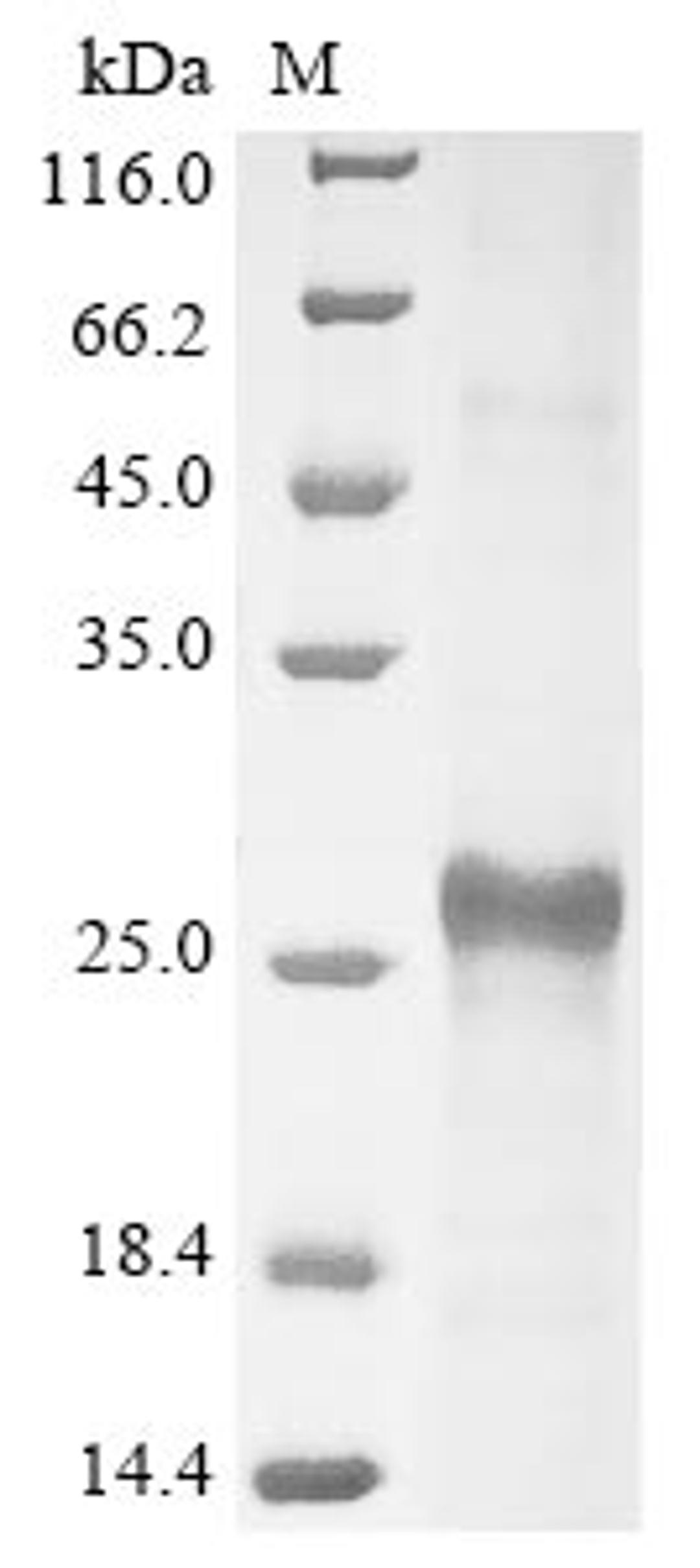 (Tris-Glycine gel) Discontinuous SDS-PAGE (reduced) with 5% enrichment gel and 15% separation gel.