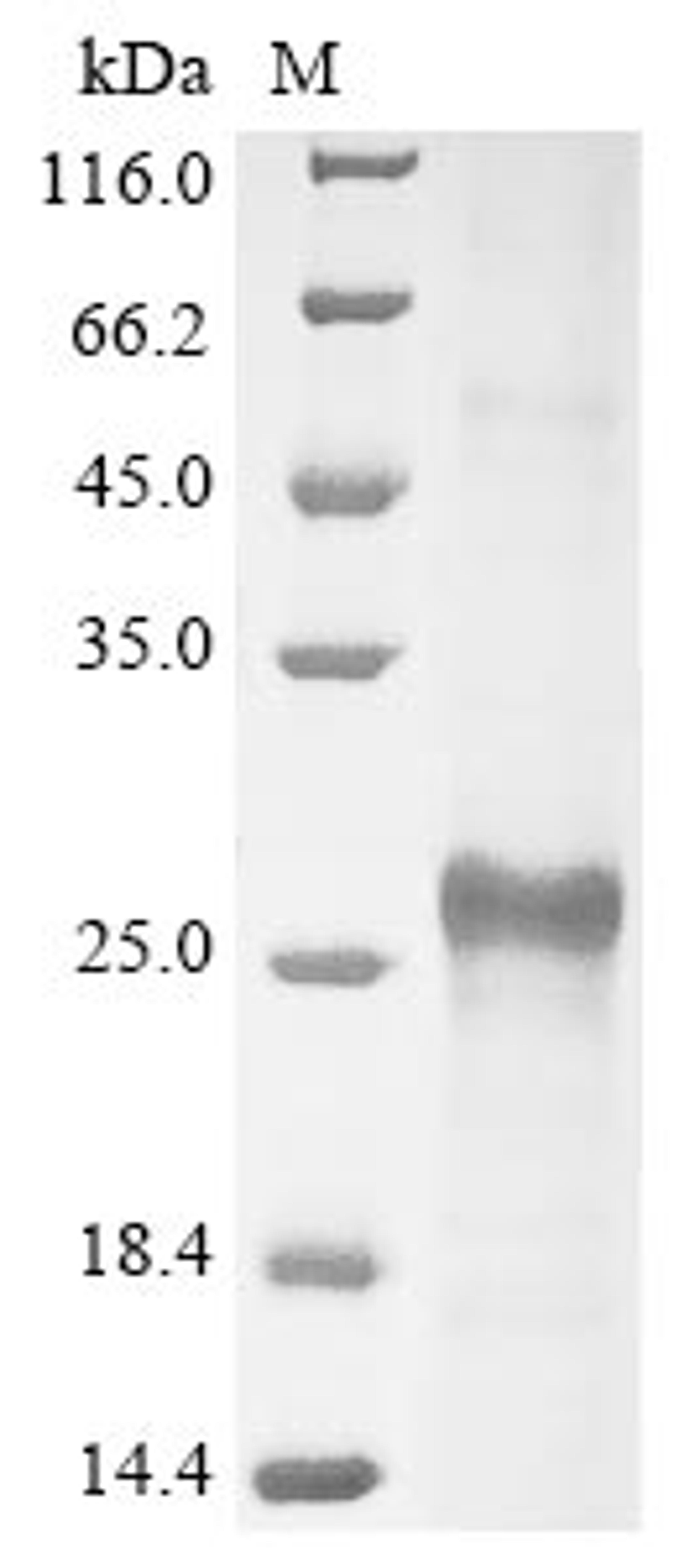 (Tris-Glycine gel) Discontinuous SDS-PAGE (reduced) with 5% enrichment gel and 15% separation gel.