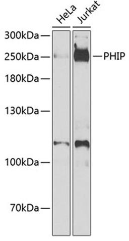 Western blot - PHIP antibody (A7207)