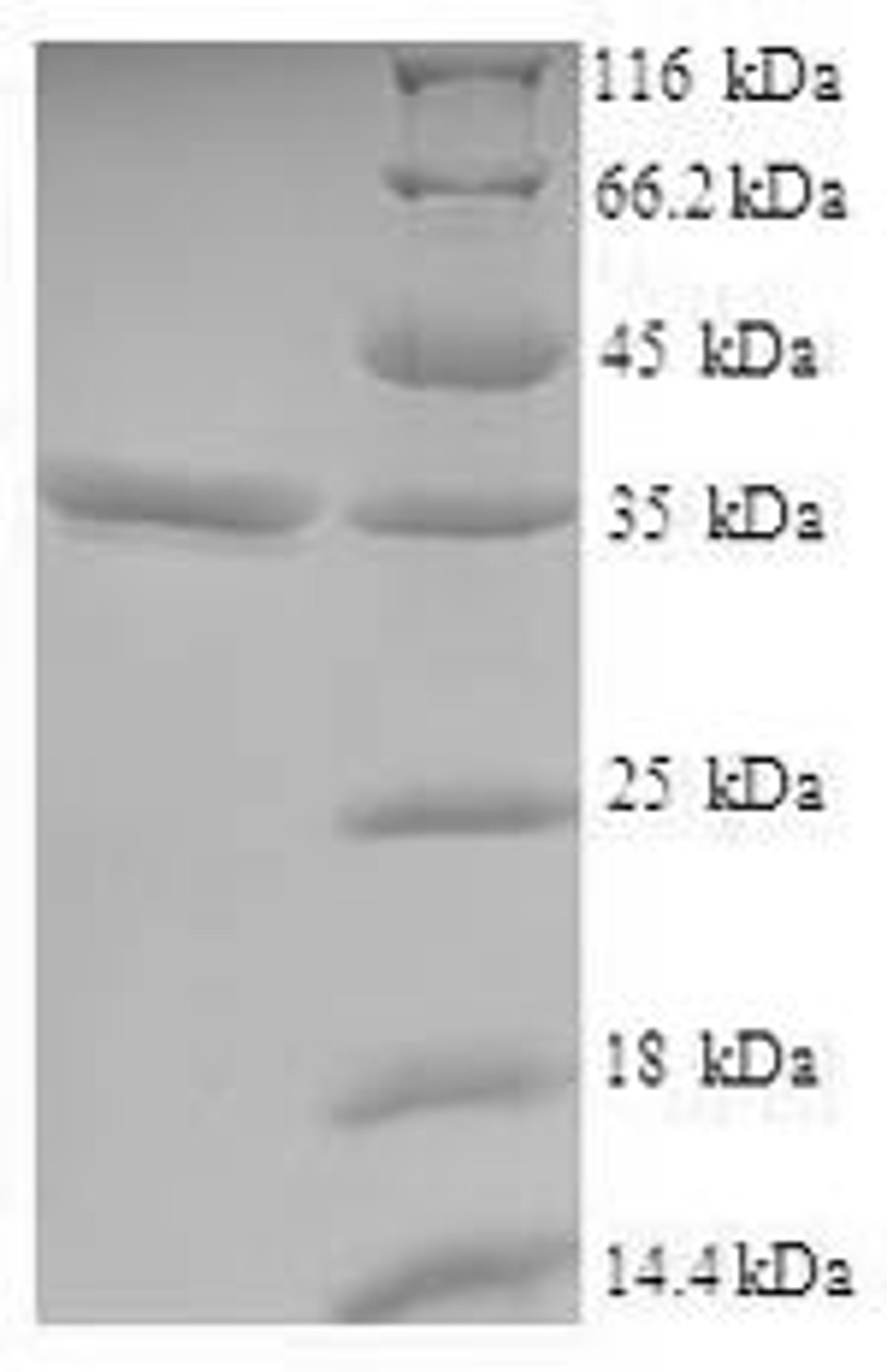 (Tris-Glycine gel) Discontinuous SDS-PAGE (reduced) with 5% enrichment gel and 15% separation gel.