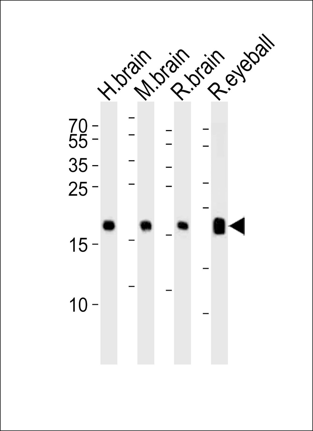 Western blot analysis of lysates from human brain, mouse brain, rat brain and rat eyeball tissue lysate (from left to right), using VILIP1 Antibody at 1:1000 at each lane.