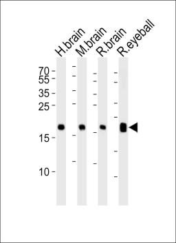 Western blot analysis of lysates from human brain, mouse brain, rat brain and rat eyeball tissue lysate (from left to right), using VILIP1 Antibody at 1:1000 at each lane.