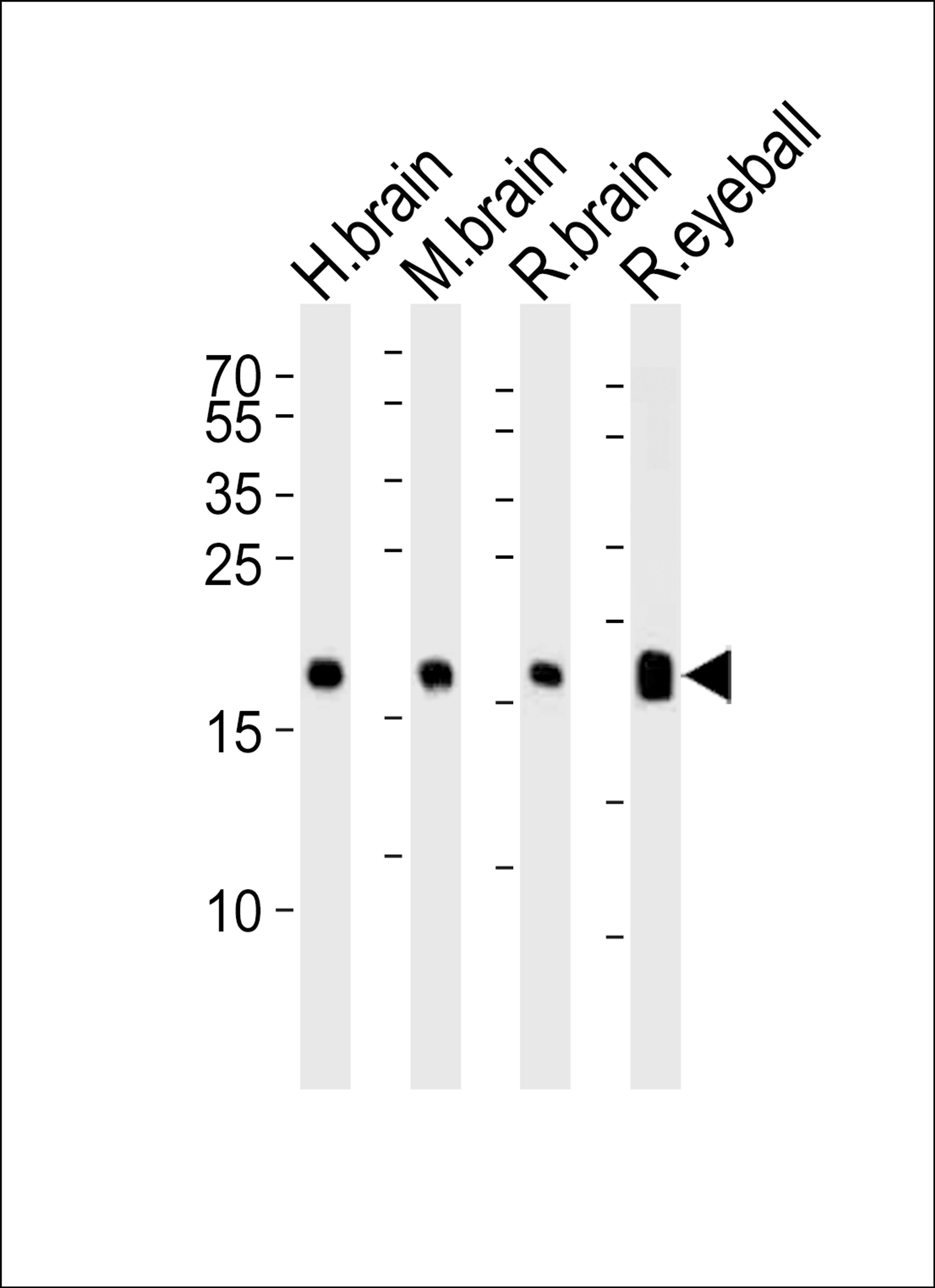 Western blot analysis of lysates from human brain, mouse brain, rat brain and rat eyeball tissue lysate (from left to right), using VILIP1 Antibody at 1:1000 at each lane.