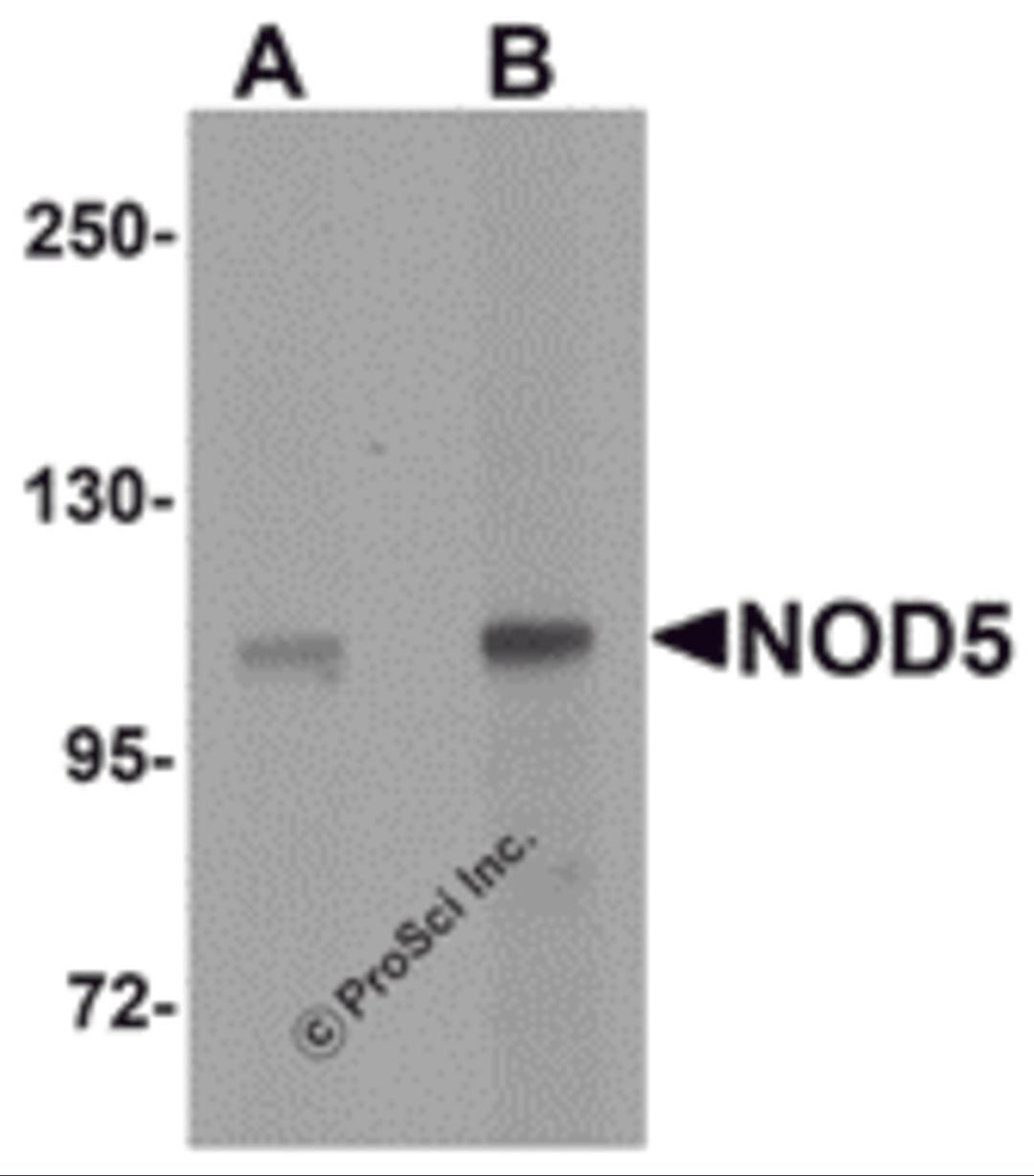 Western blot analysis of NOD5 in rat spleen tissue cell lysate with NOD5 antibody at (A) 1 and (B) 2 &#956;g/mL.