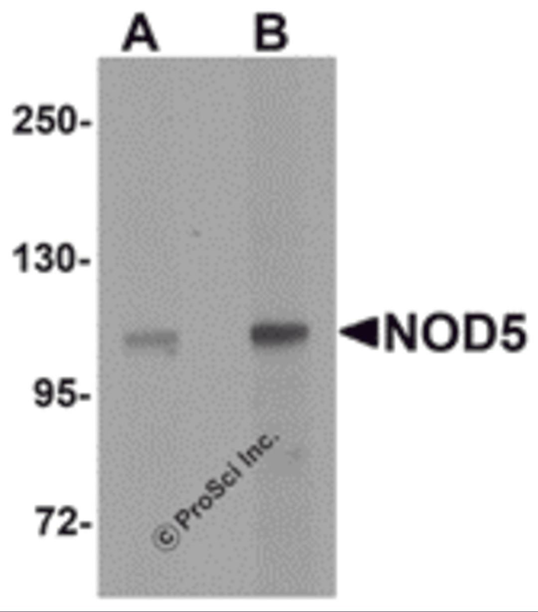 Western blot analysis of NOD5 in rat spleen tissue cell lysate with NOD5 antibody at (A) 1 and (B) 2 μg/mL.