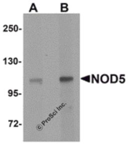 Western blot analysis of NOD5 in rat spleen tissue cell lysate with NOD5 antibody at (A) 1 and (B) 2 μg/mL.