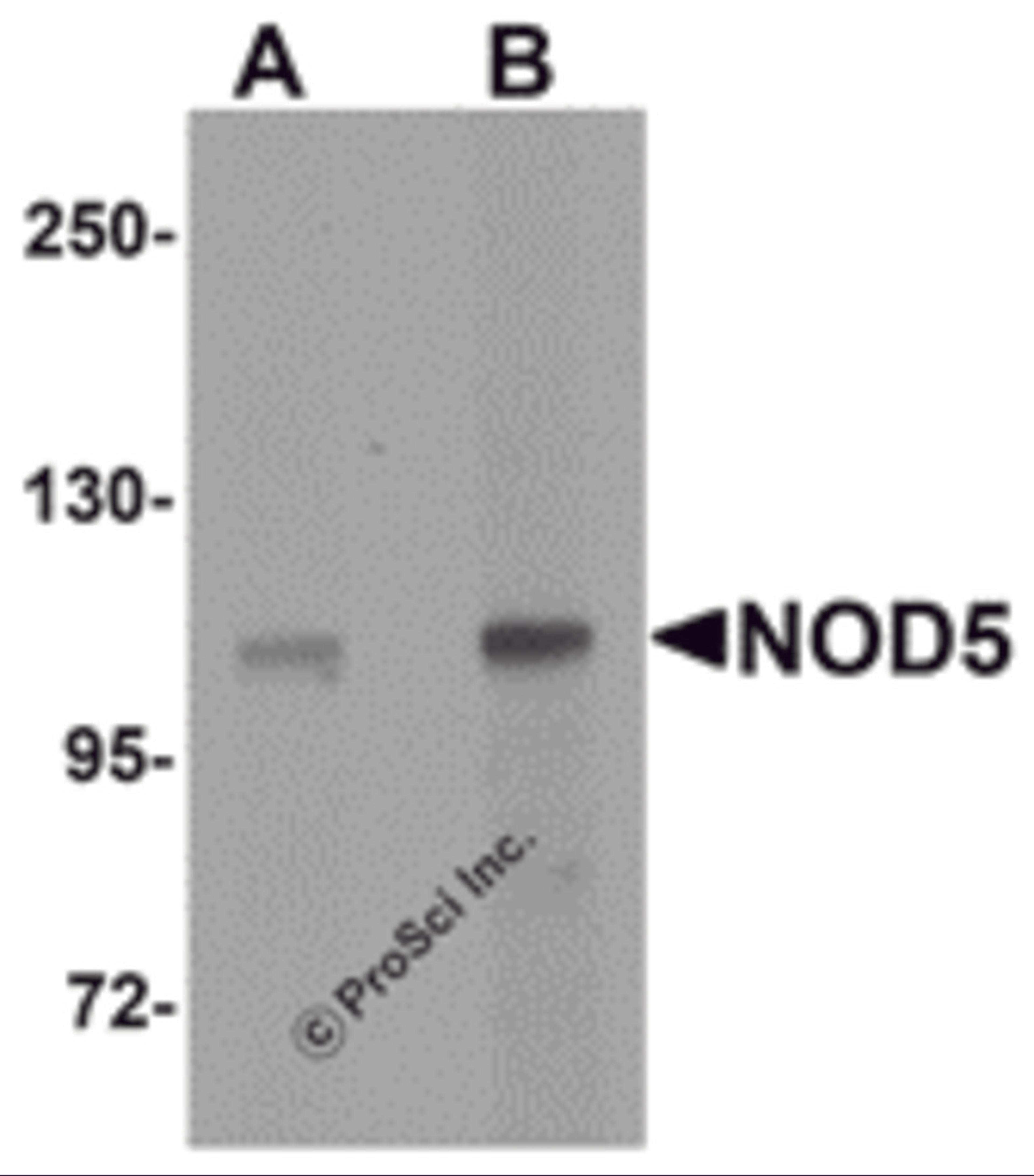 Western blot analysis of NOD5 in rat spleen tissue cell lysate with NOD5 antibody at (A) 1 and (B) 2 μg/mL.