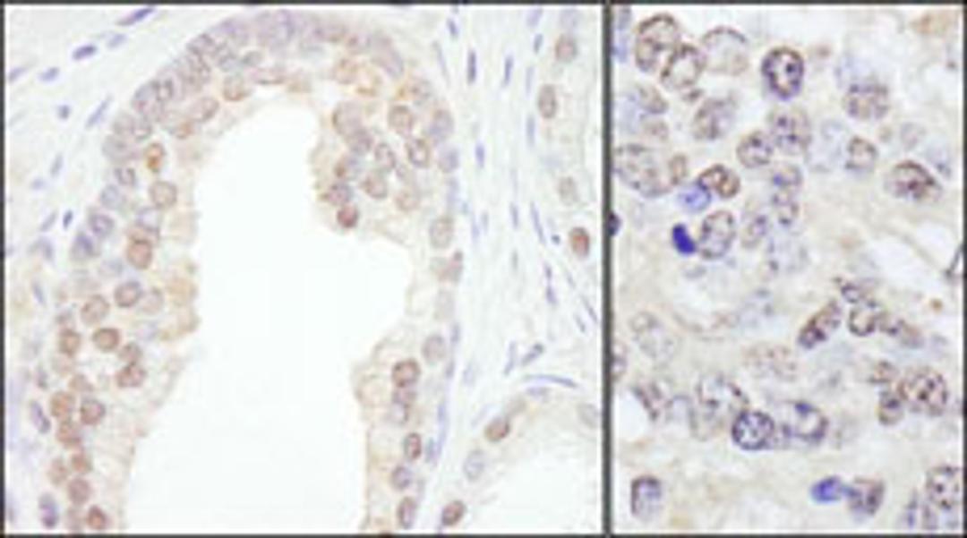 Detection of human and mouse TRIM33/TIF1gamma by immunohistochemistry.