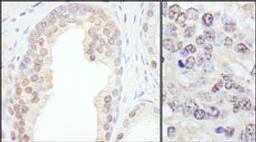 Detection of human and mouse TRIM33/TIF1gamma by immunohistochemistry.