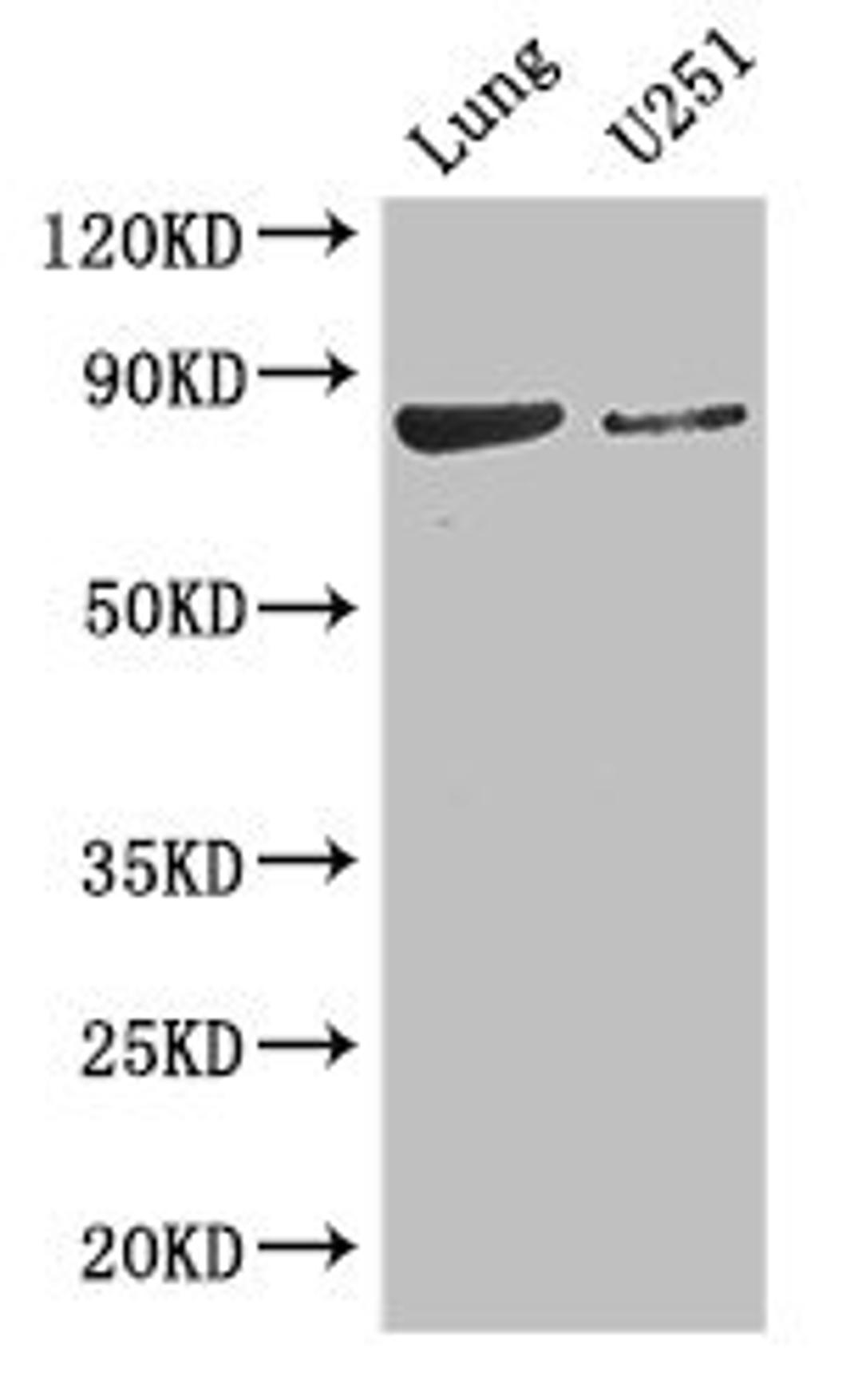 Western Blot. Positive WB detected in: Mouse lung tissue, U251 whole cell lysate. All lanes: YTHDC1 antibody at 3.4ug/ml. Secondary. Goat polyclonal to rabbit IgG at 1/50000 dilution. Predicted band size: 85, 83 kDa. Observed band size: 85 kDa. 