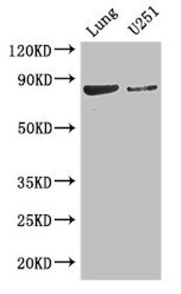 Western Blot. Positive WB detected in: Mouse lung tissue, U251 whole cell lysate. All lanes: YTHDC1 antibody at 3.4ug/ml. Secondary. Goat polyclonal to rabbit IgG at 1/50000 dilution. Predicted band size: 85, 83 kDa. Observed band size: 85 kDa. 