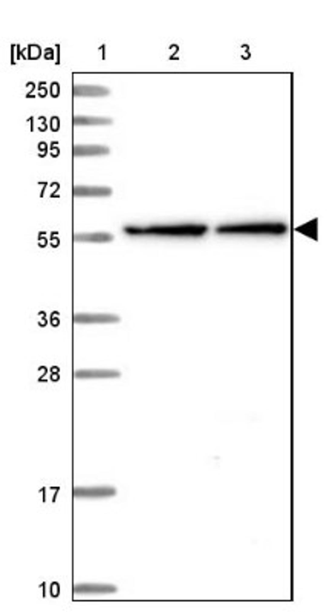 Western Blot: NEURL1B Antibody [NBP1-90499] - Lane 1: Marker [kDa] 250, 130, 95, 72, 55, 36, 28, 17, 10<br/>Lane 2: Human cell line RT-4<br/>Lane 3: Human cell line U-251MG sp