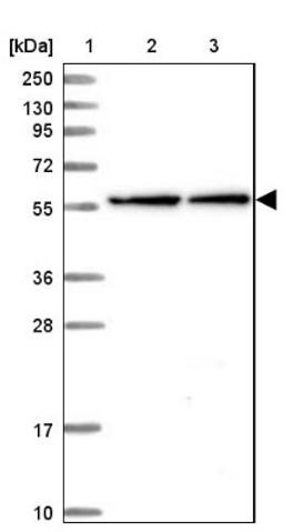 Western Blot: NEURL1B Antibody [NBP1-90499] - Lane 1: Marker [kDa] 250, 130, 95, 72, 55, 36, 28, 17, 10<br/>Lane 2: Human cell line RT-4<br/>Lane 3: Human cell line U-251MG sp