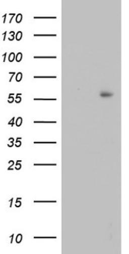 Western Blot: TRIM27 Antibody (4D4) [NBP2-46214] - Analysis of HEK293T cells were transfected with the pCMV6-ENTRY control (Left lane) or pCMV6-ENTRY TRIM27.