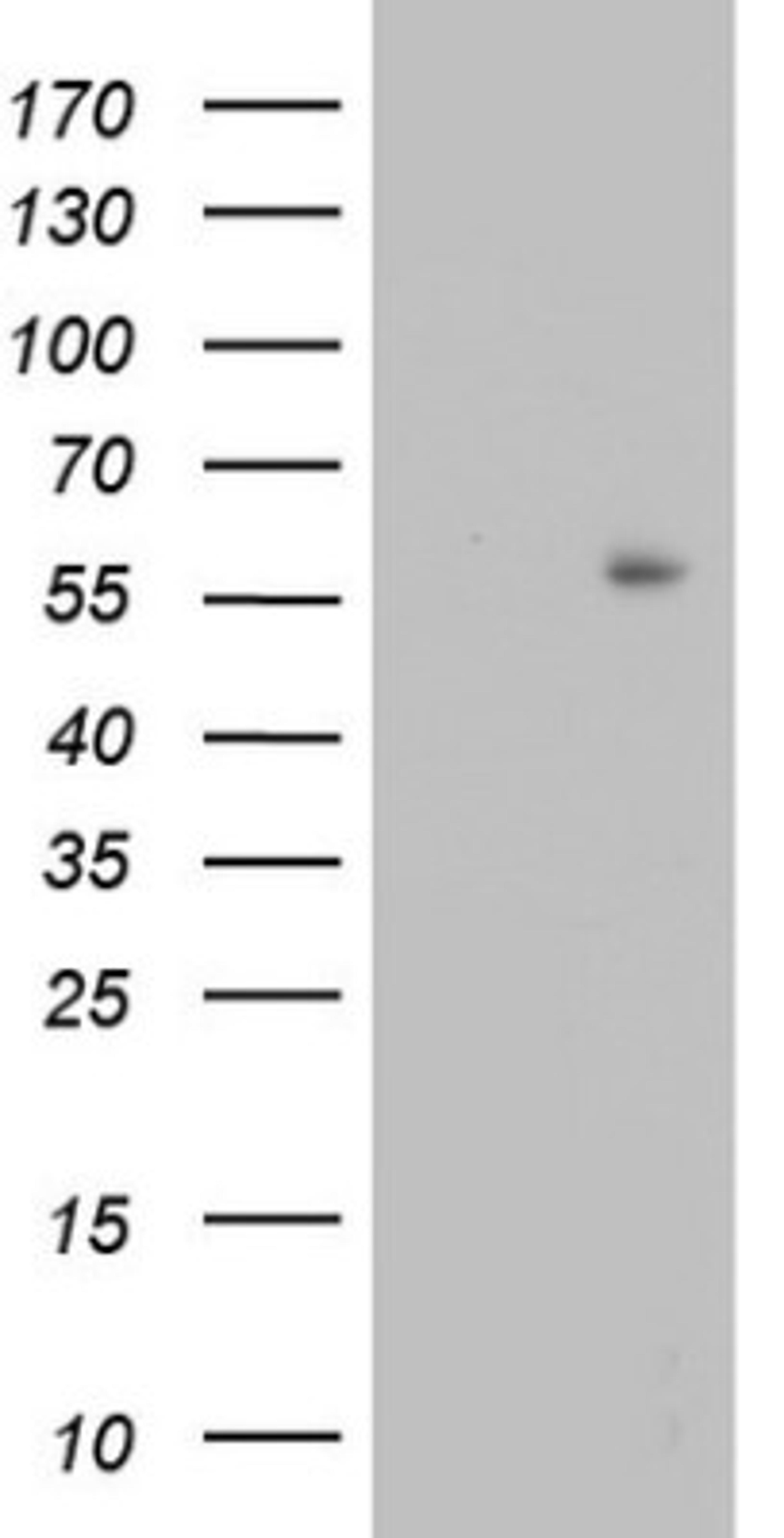 Western Blot: TRIM27 Antibody (4D4) [NBP2-46214] - Analysis of HEK293T cells were transfected with the pCMV6-ENTRY control (Left lane) or pCMV6-ENTRY TRIM27.