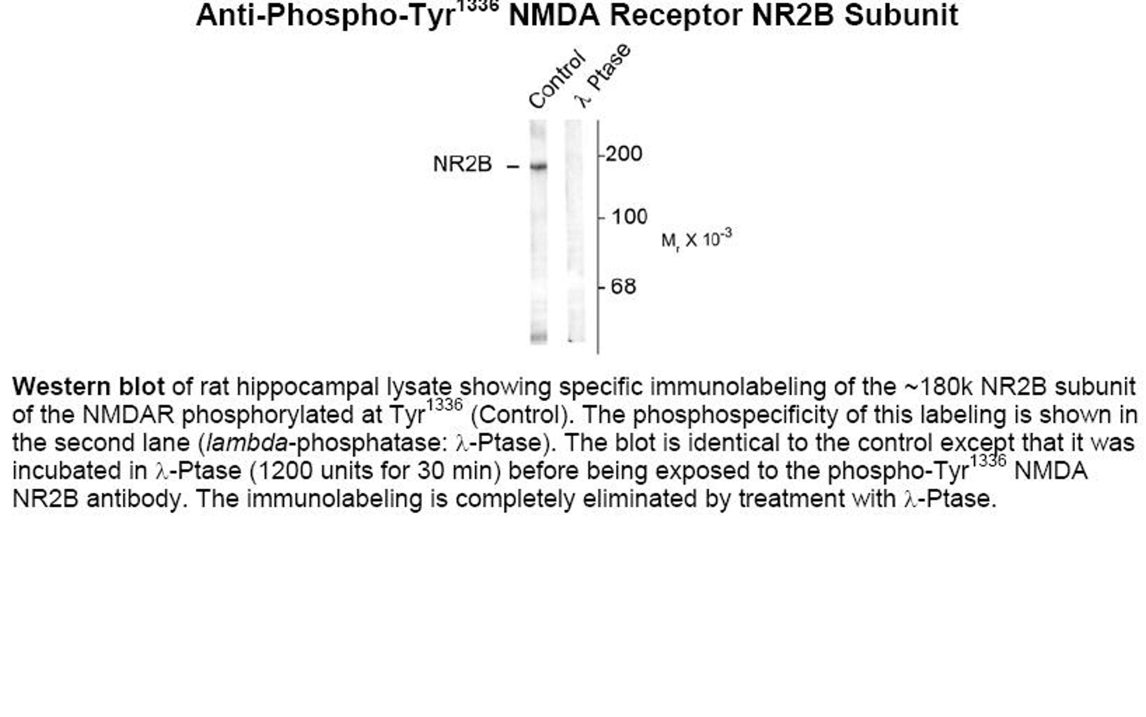 Western blot of rat hippocampal lysate showing specific immunolabeling of the ~180k NR2B subunit of the NMDAR phosphorylated at Tyr1336 (Control). The phosphospecificity of this labeling is shown in the second lane (lambda-phosphatase: lamda-Ptase). The b