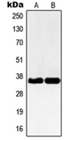 Western blot analysis of Jurkat (Lane 1), HEK293 (Lane 2) whole cell lysates using NBPF12 antibody