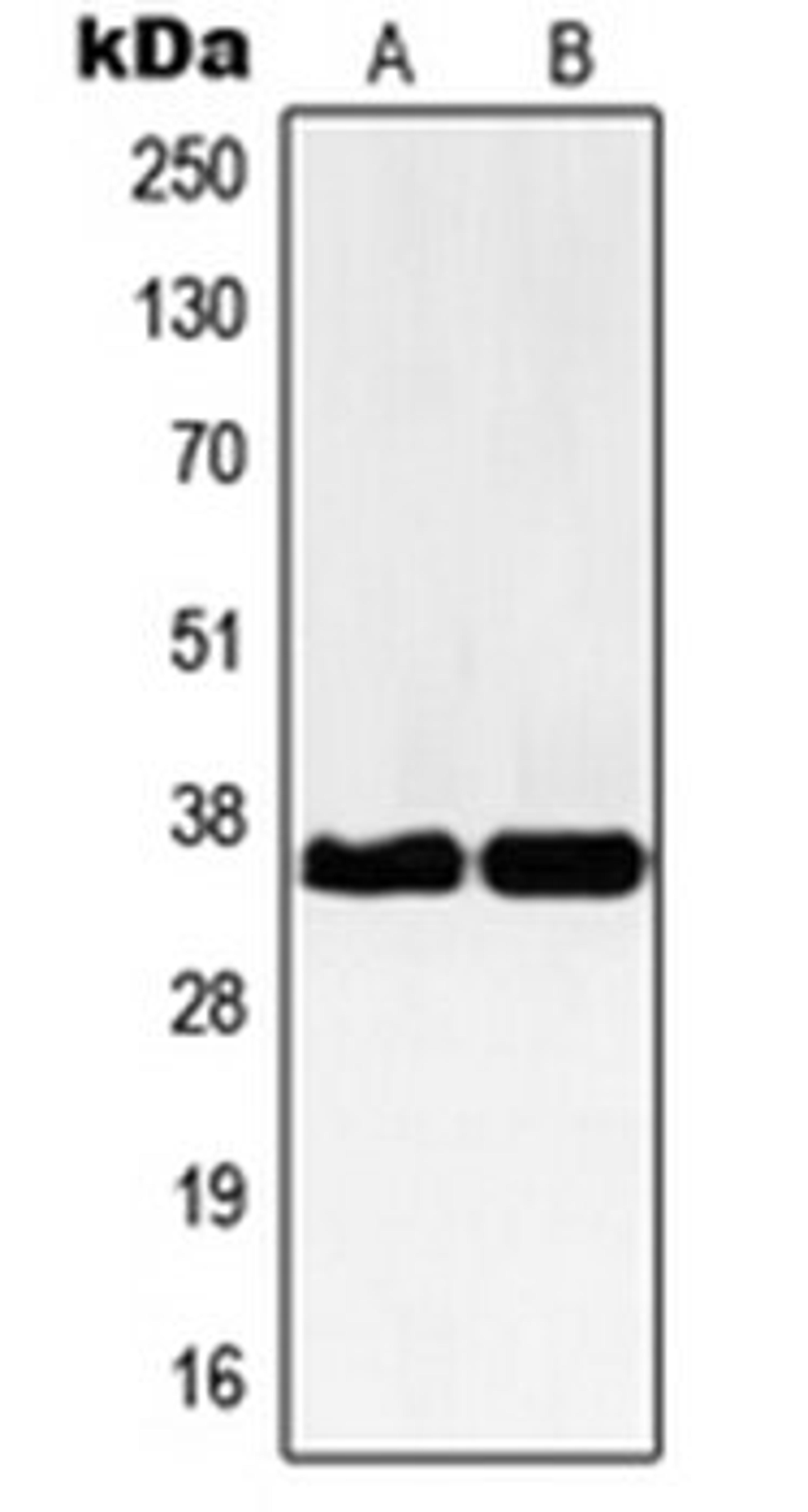 Western blot analysis of Jurkat (Lane 1), HEK293 (Lane 2) whole cell lysates using NBPF12 antibody