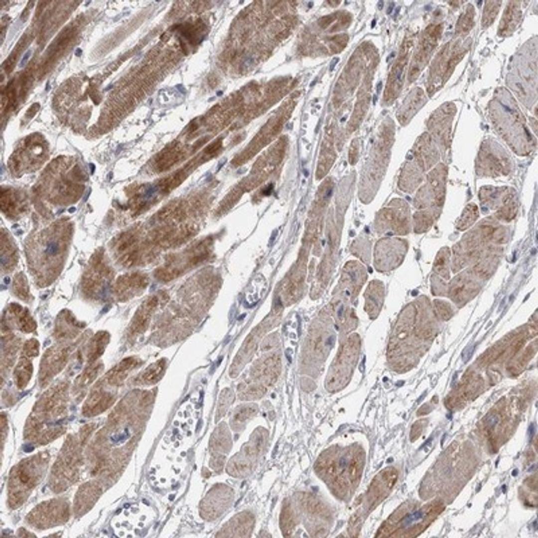 Immunohistochemistry-Paraffin: TCAP Antibody [NBP1-85544] - Staining of human heart muscle shows distinct cytoplasmic positivity.