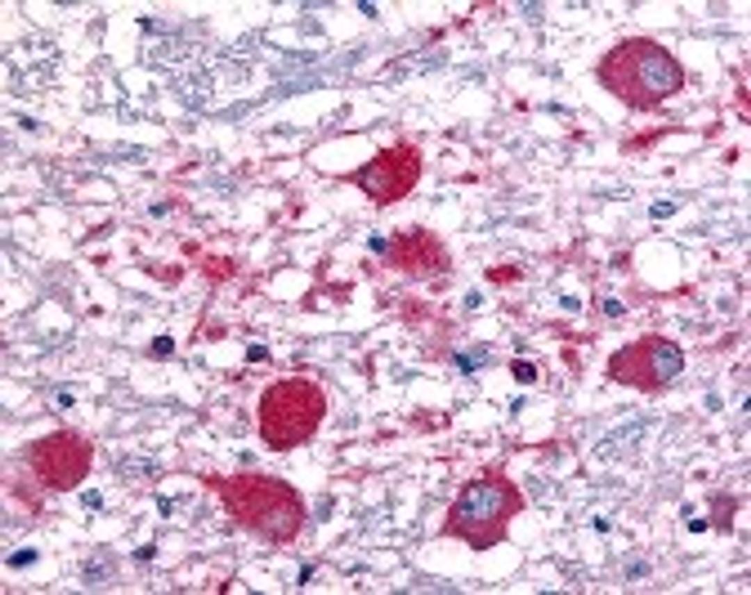 Immunohistochemistry staining of Roundabout in brain tissue using Roundabout Antibody.