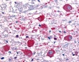 Immunohistochemistry staining of Roundabout in brain tissue using Roundabout Antibody.