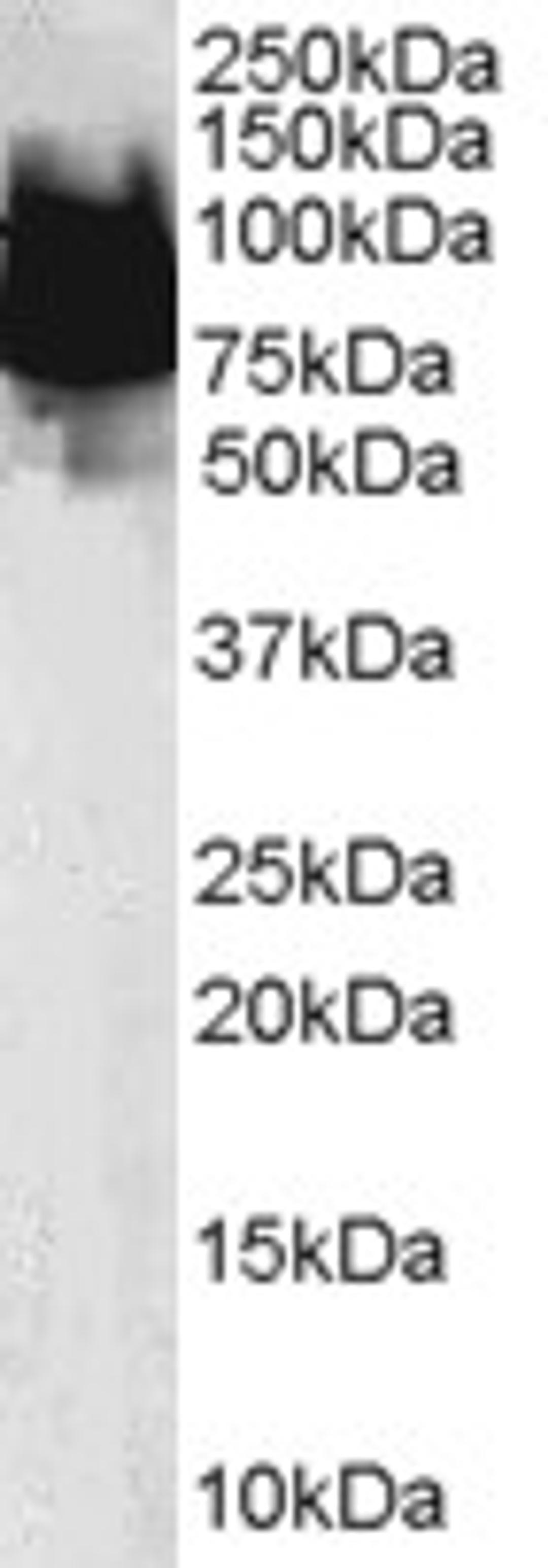 45-806 (0.1ug/ml) staining of Human Duodenum lysate (35ug protein in RIPA buffer). Primary incubation was 1 hour. Detected by chemiluminescence.