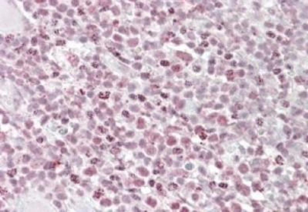 Immunohistochemistry-Paraffin: Ikaros/IKZF1 Antibody [NBP1-51990] - NBP1-51990 (3.8ug/ml) staining of paraffin embedded Human Tonsil. Steamed antigen retrieval with citrate buffer pH 6, AP-staining.