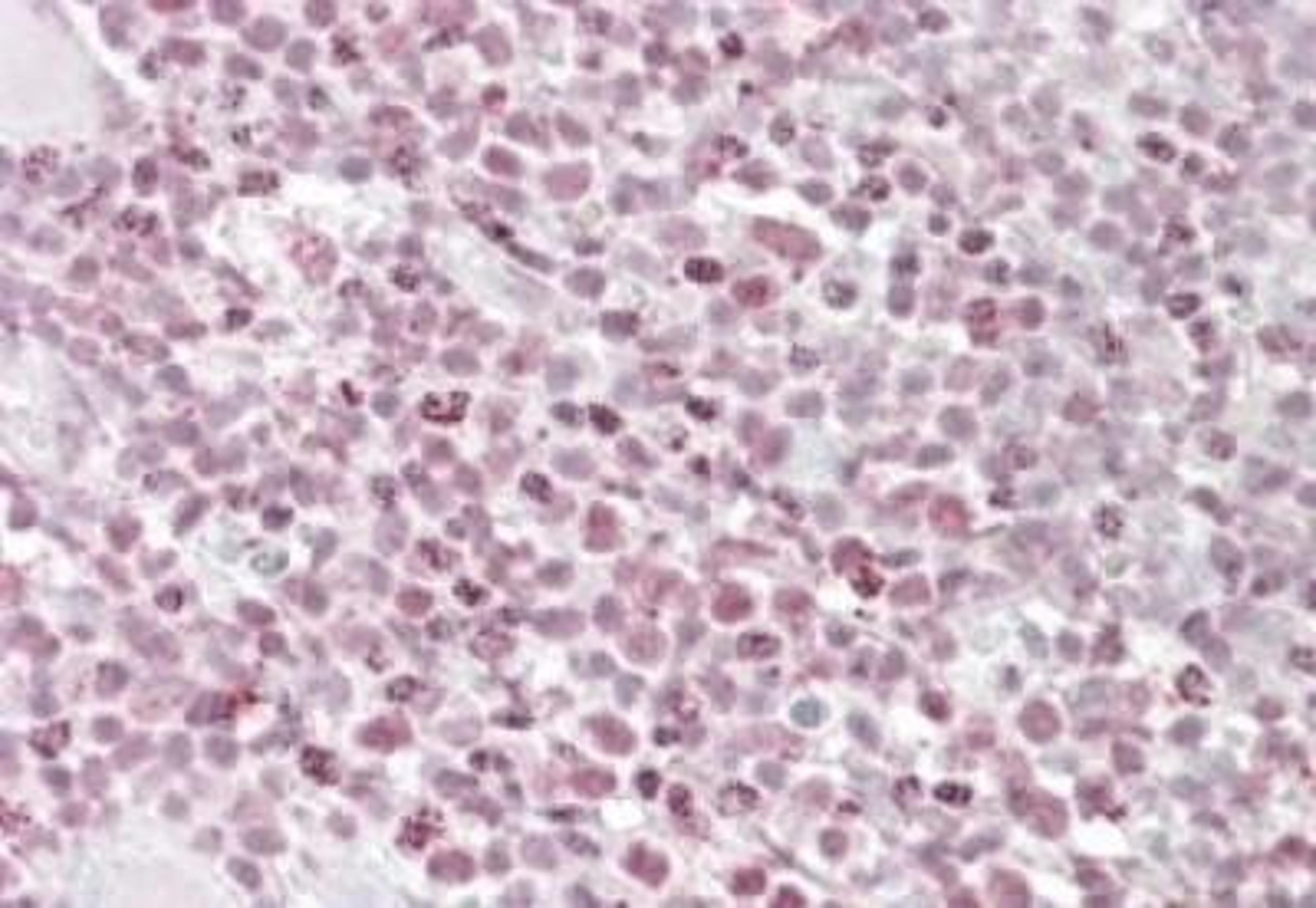 Immunohistochemistry-Paraffin: Ikaros/IKZF1 Antibody [NBP1-51990] - NBP1-51990 (3.8ug/ml) staining of paraffin embedded Human Tonsil. Steamed antigen retrieval with citrate buffer pH 6, AP-staining.