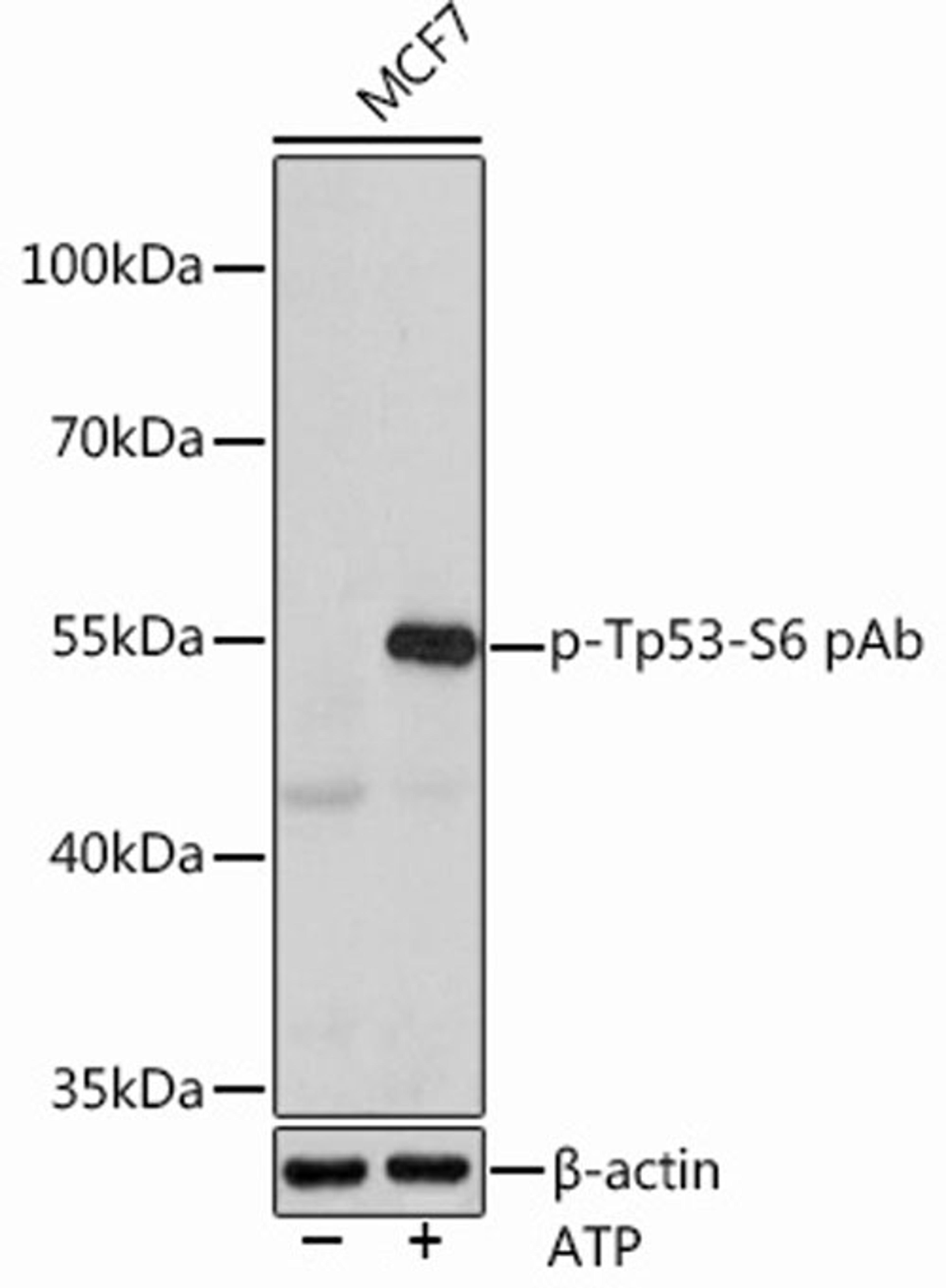 Western blot - Phospho-Tp53-S6 antibody (AP0951)