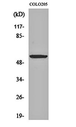 Western blot analysis of COLO205 cell lysates using Dok-2 antibody