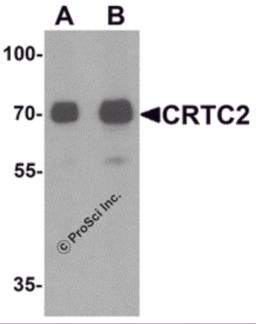 Western blot analysis of CRTC2 in human small intestine tissue lysate with CRTC2 antibody at (A) 0.5 and (B) 1 &#956;g/mL.