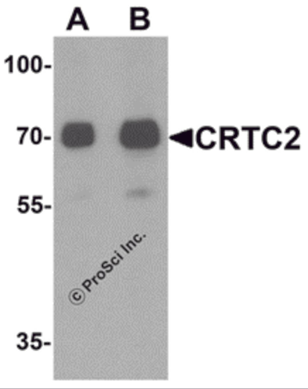 Western blot analysis of CRTC2 in human small intestine tissue lysate with CRTC2 antibody at (A) 0.5 and (B) 1 μg/mL.