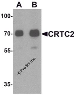 Western blot analysis of CRTC2 in human small intestine tissue lysate with CRTC2 antibody at (A) 0.5 and (B) 1 μg/mL.