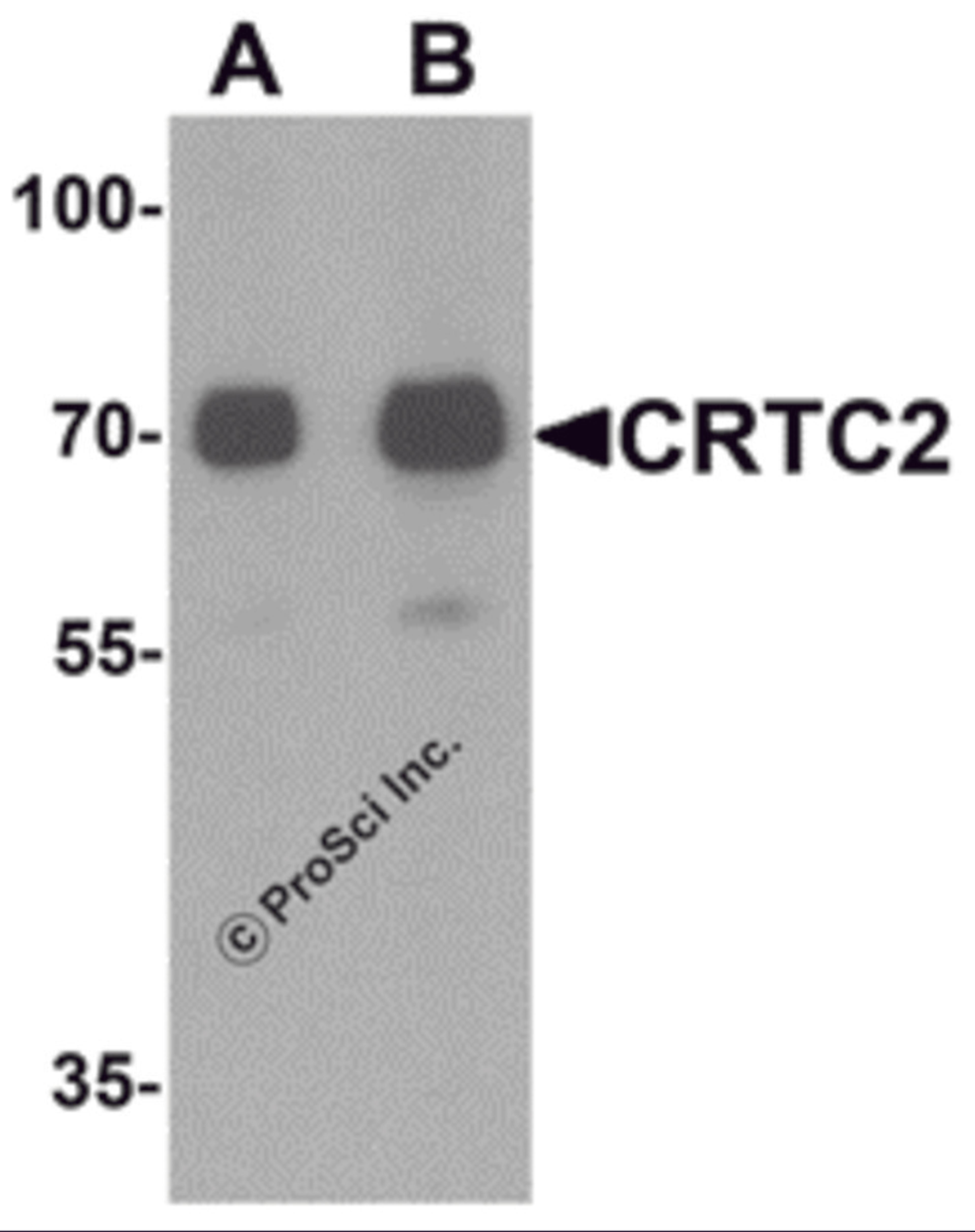 Western blot analysis of CRTC2 in human small intestine tissue lysate with CRTC2 antibody at (A) 0.5 and (B) 1 μg/mL.