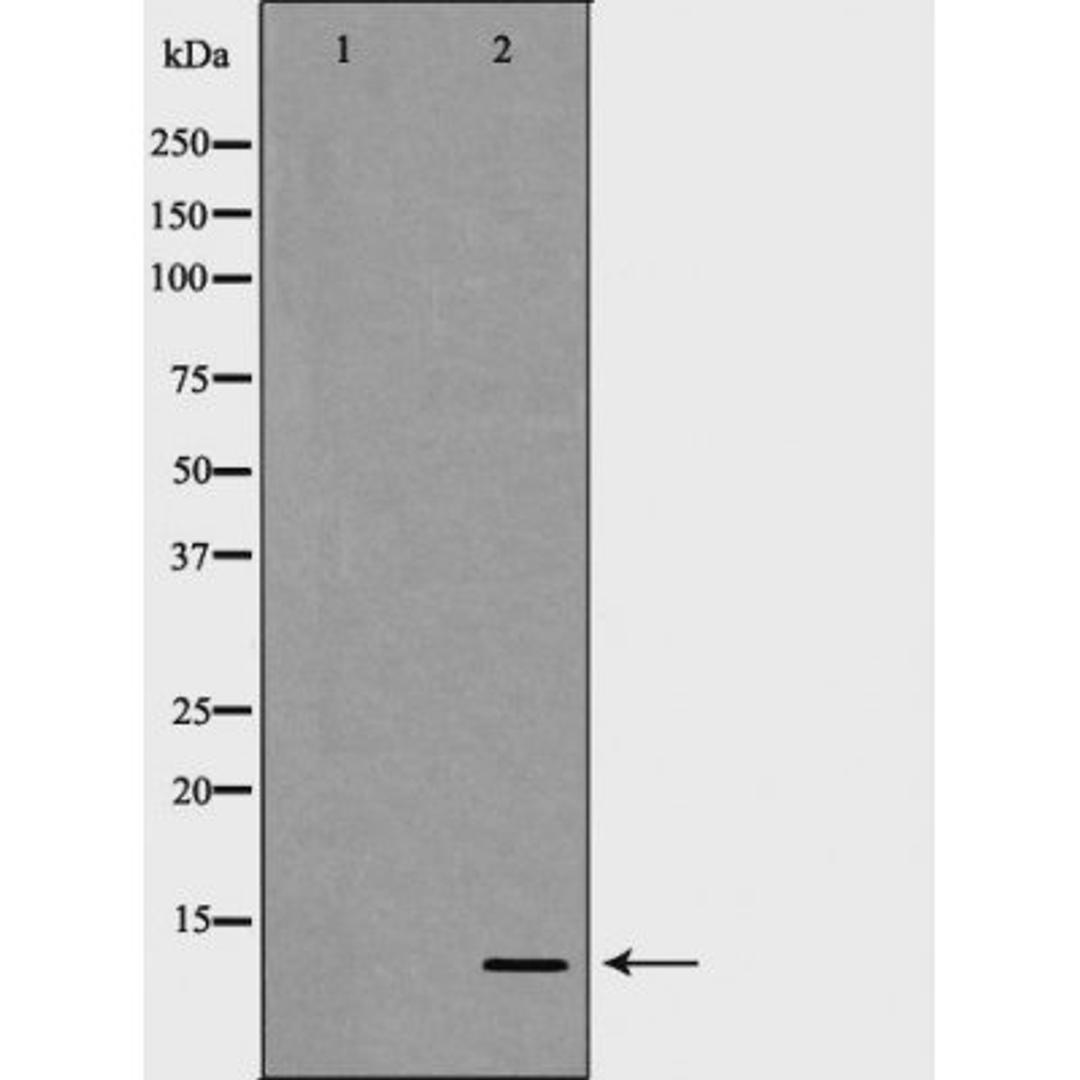 Western blot analysis of human Placenta lysate using S100 A4 antibody