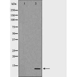 Western blot analysis of human Placenta lysate using S100 A4 antibody