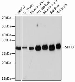 Western blot - SDHB Rabbit mAb (A1809)