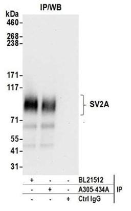 Detection of human SV2A by western blot of immunoprecipitates.