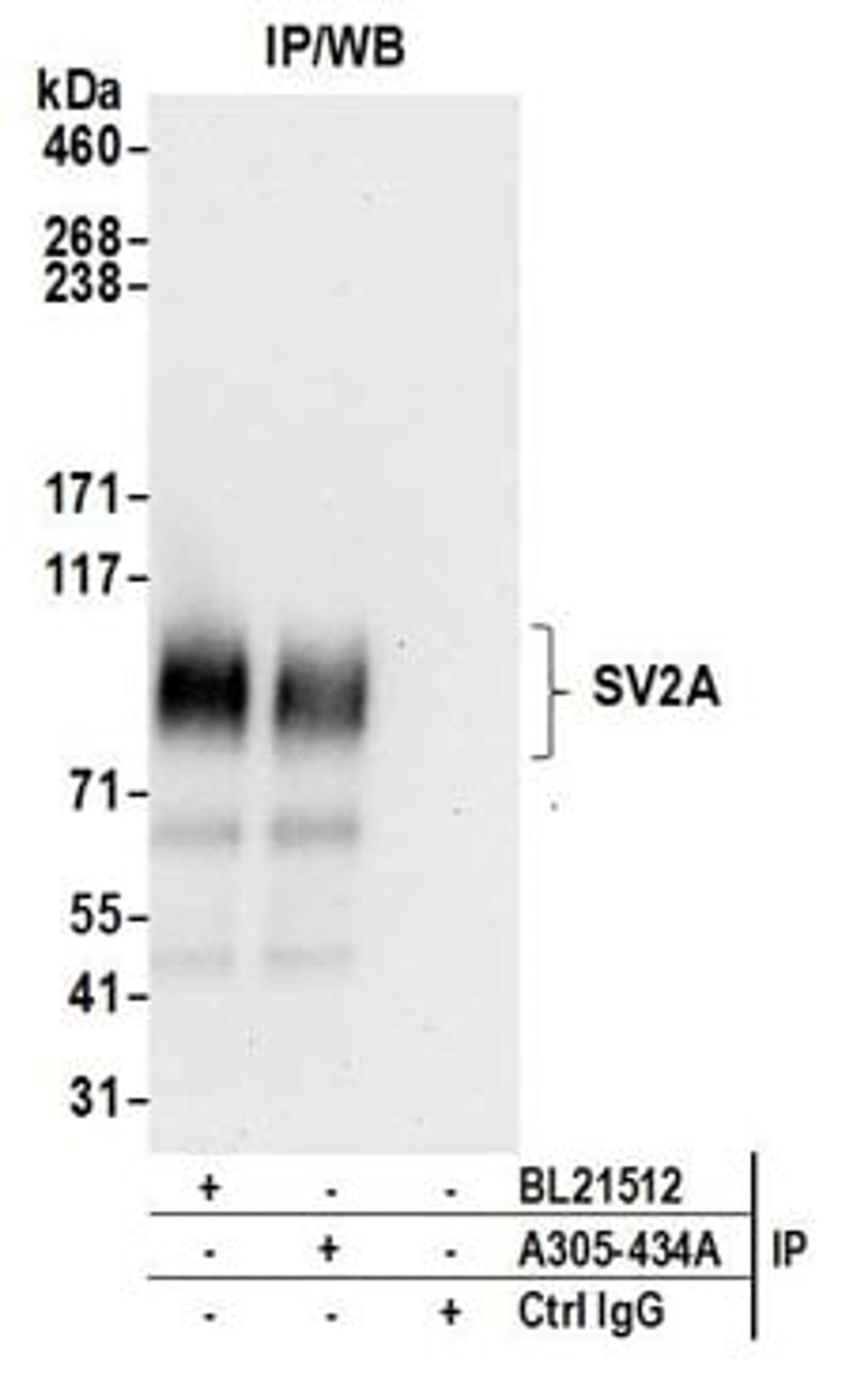 Detection of human SV2A by western blot of immunoprecipitates.