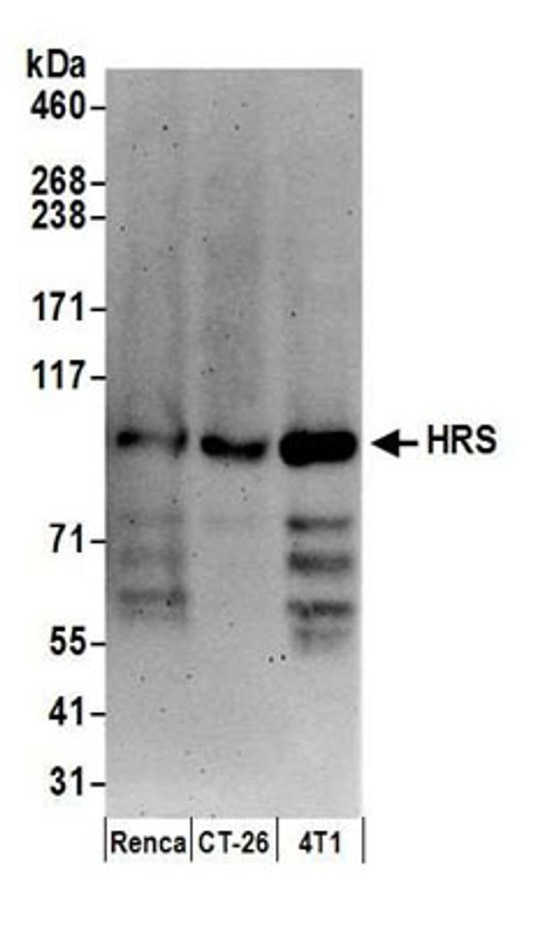 Detection of mouse HRS by western blot.