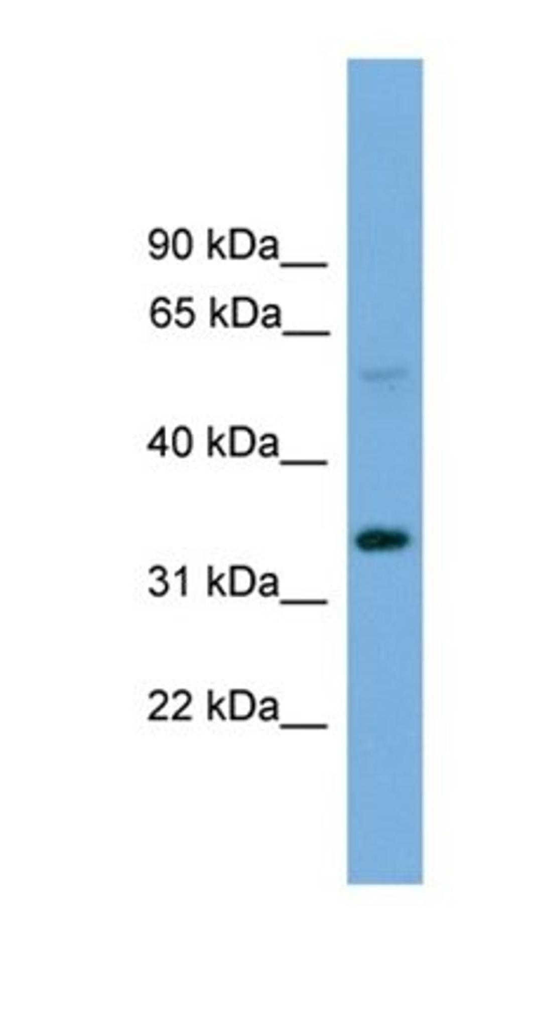 Western blot analysis of OVCAR-3 cell lysate tissue using DCSTAMP antibody