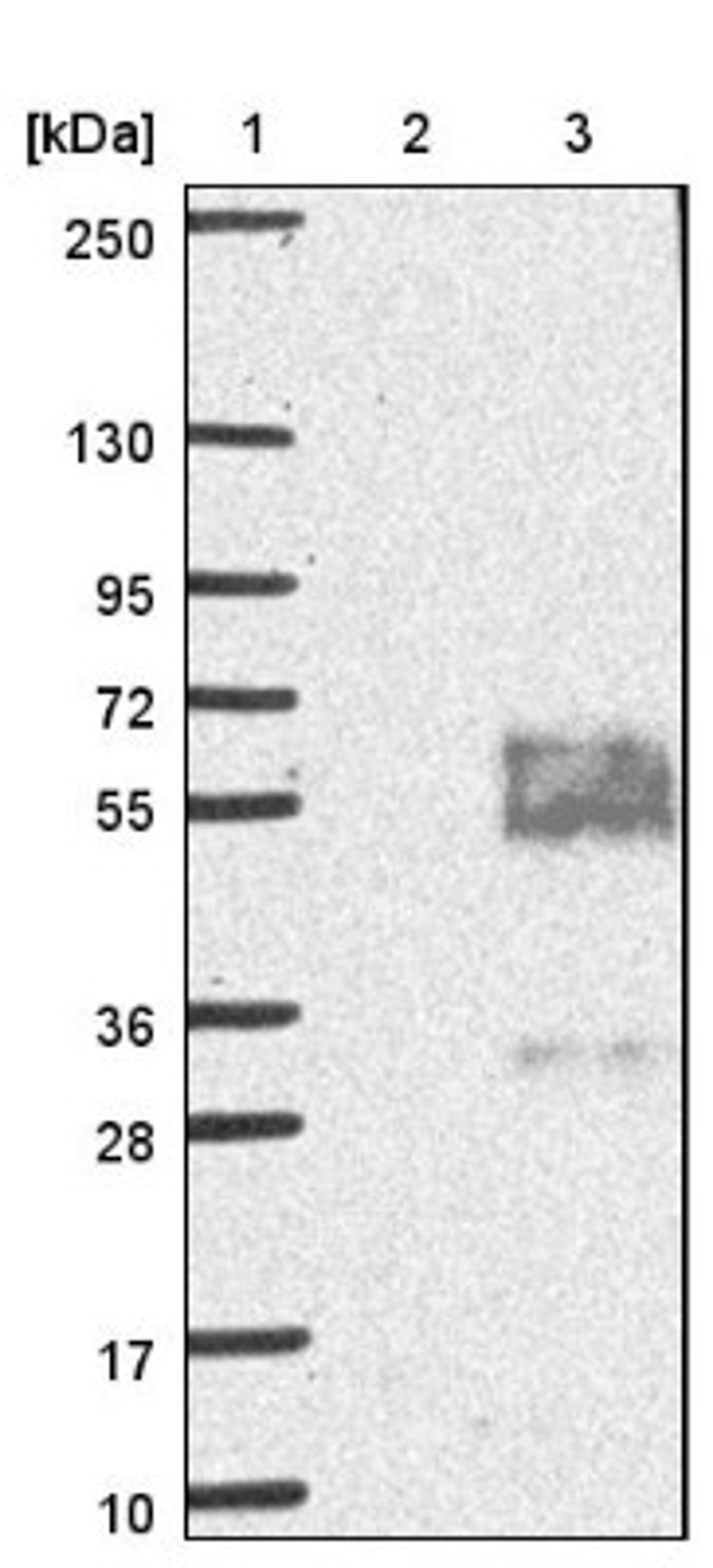 Western Blot: MFSD8 Antibody [NBP1-92114] - Lane 1: Marker [kDa] 250, 130, 95, 72, 55, 36, 28, 17, 10<br/>Lane 2: Negative control (vector only transfected HEK293T lysate)<br/>Lane 3: Over-expression lysate (Co-expressed with a C-terminal myc-DDK tag (~3.1 kDa) in mammalian HEK293T cells, LY407271)