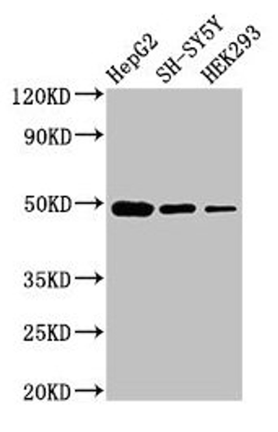 Western Blot. Positive WB detected in: HepG2 whole cell lysate, SH-SY5Y whole cell lysate, HEK293 whole cell lysate. All lanes: FDFT1 antibody at 3µg/ml. Secondary. Goat polyclonal to rabbit IgG at 1/50000 dilution. Predicted band size: 49, 41, 39, 36, 44 kDa. Observed band size: 49 kDa