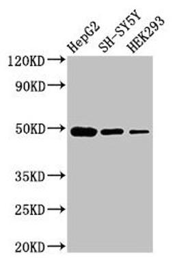 Western Blot. Positive WB detected in: HepG2 whole cell lysate, SH-SY5Y whole cell lysate, HEK293 whole cell lysate. All lanes: FDFT1 antibody at 3µg/ml. Secondary. Goat polyclonal to rabbit IgG at 1/50000 dilution. Predicted band size: 49, 41, 39, 36, 44 kDa. Observed band size: 49 kDa