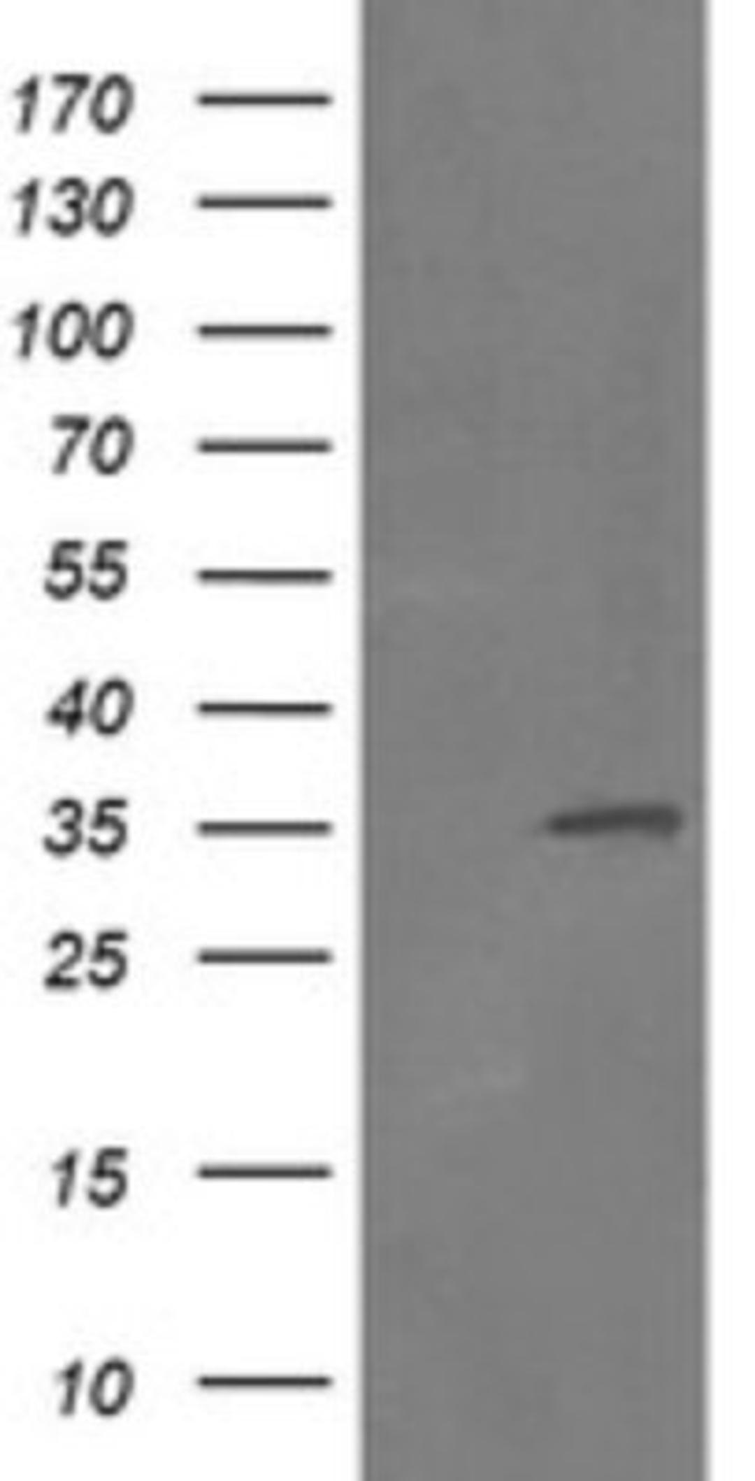 Western Blot: RFC2 Antibody (2B2) [NBP2-45570] - Analysis of HEK293T cells were transfected with the pCMV6-ENTRY control (Left lane) or pCMV6-ENTRY RFC2.